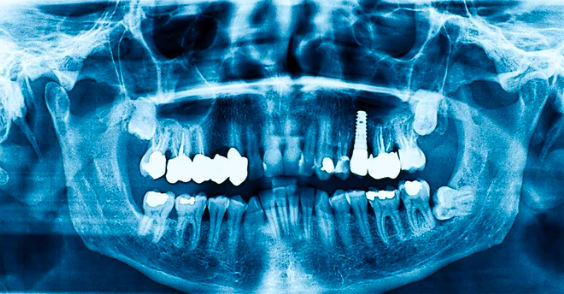 スクリーンショット 2025-12-26 10.16.27